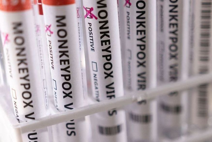 Paraíba contabiliza 41 casos suspeitos de varíola do macaco espalhados em 19 cidades