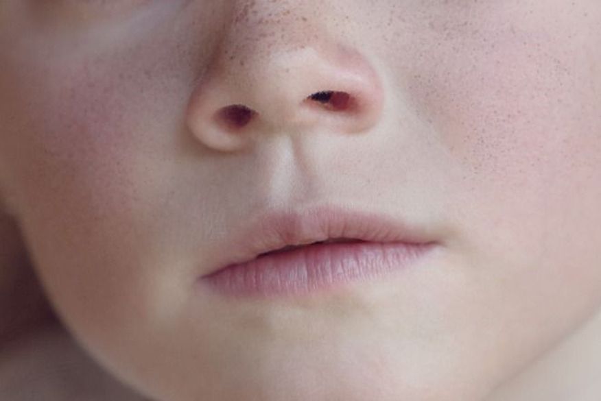 Perda de olfato por Covid-19 pode durar um ano, indica estudo